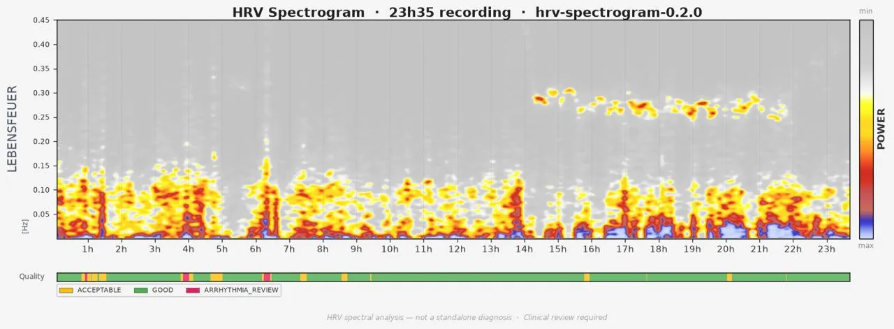 ECG & HRV